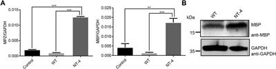 Bioengineered silkworm model for expressing human neurotrophin-4 with potential biomedical application